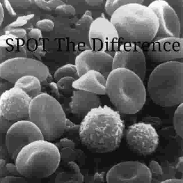 SPOT_The_Difference.jpg